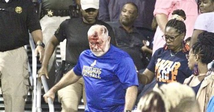 Beaten, bloodied and booted | Free News