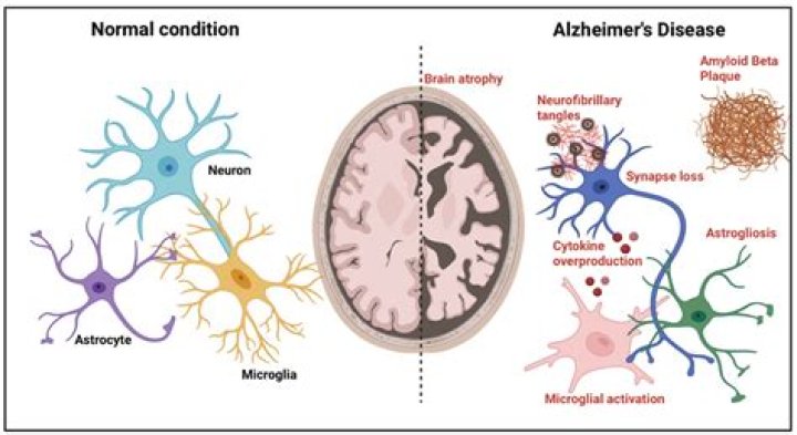 Dementia and coronavirus risk | Alzheimer's Society