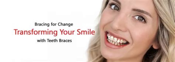 From Crooked to Confident: Transforming Your Smile with Braces