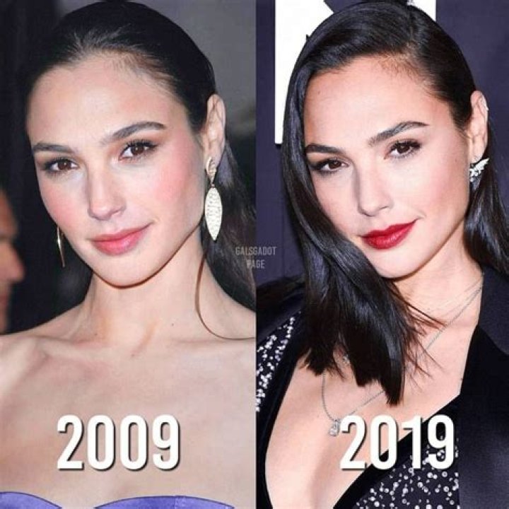 Gal Gadot Chirurgie