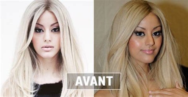 La Zarra Chirurgie Esthétique