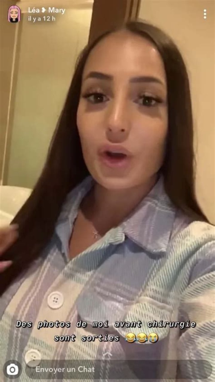 Lea Mary Avant Chirurgie