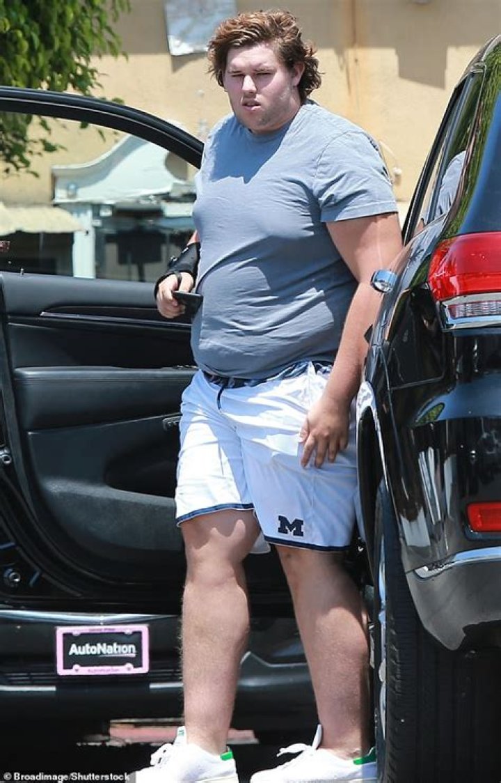 The 64-Year-Old Has Been Gradually Losing Weight!