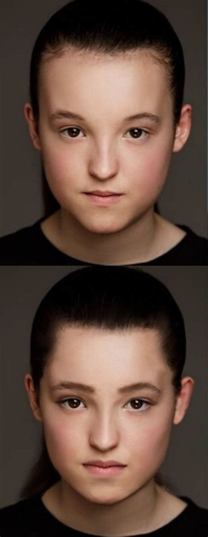 What's Wrong With Bella Ramsey's Face? Her Illness Discussed